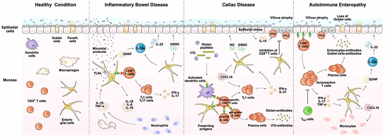 Diagram showing how the enteric nervous system interacts with the immune system.