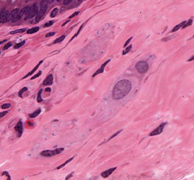 Photomicrograph showing the histology of the submucosal plexus.