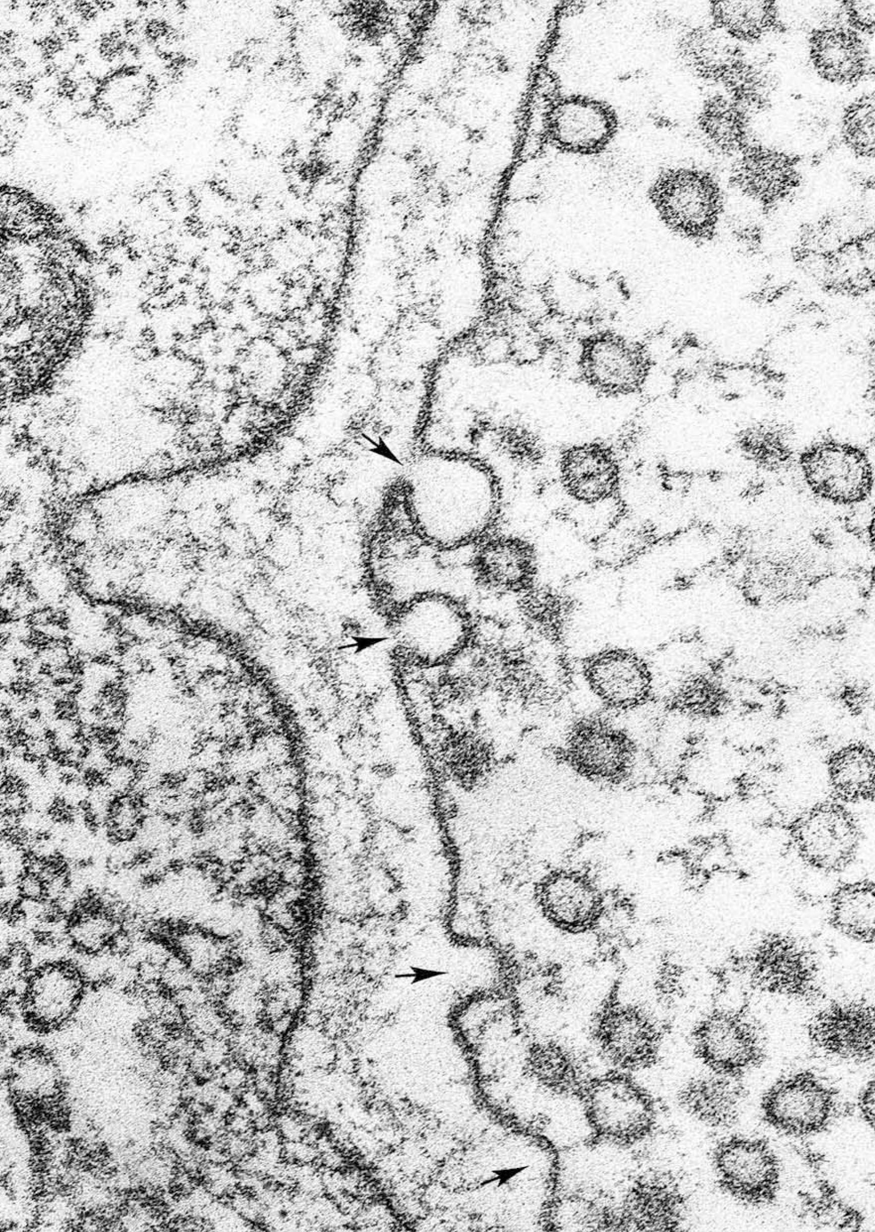 An electron micrograph of omega figures which result from vesicle fusion.