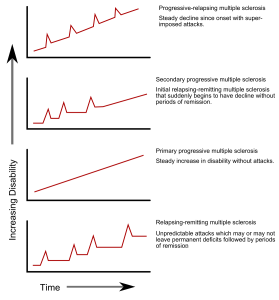 Stages of Multiple Sclerosis