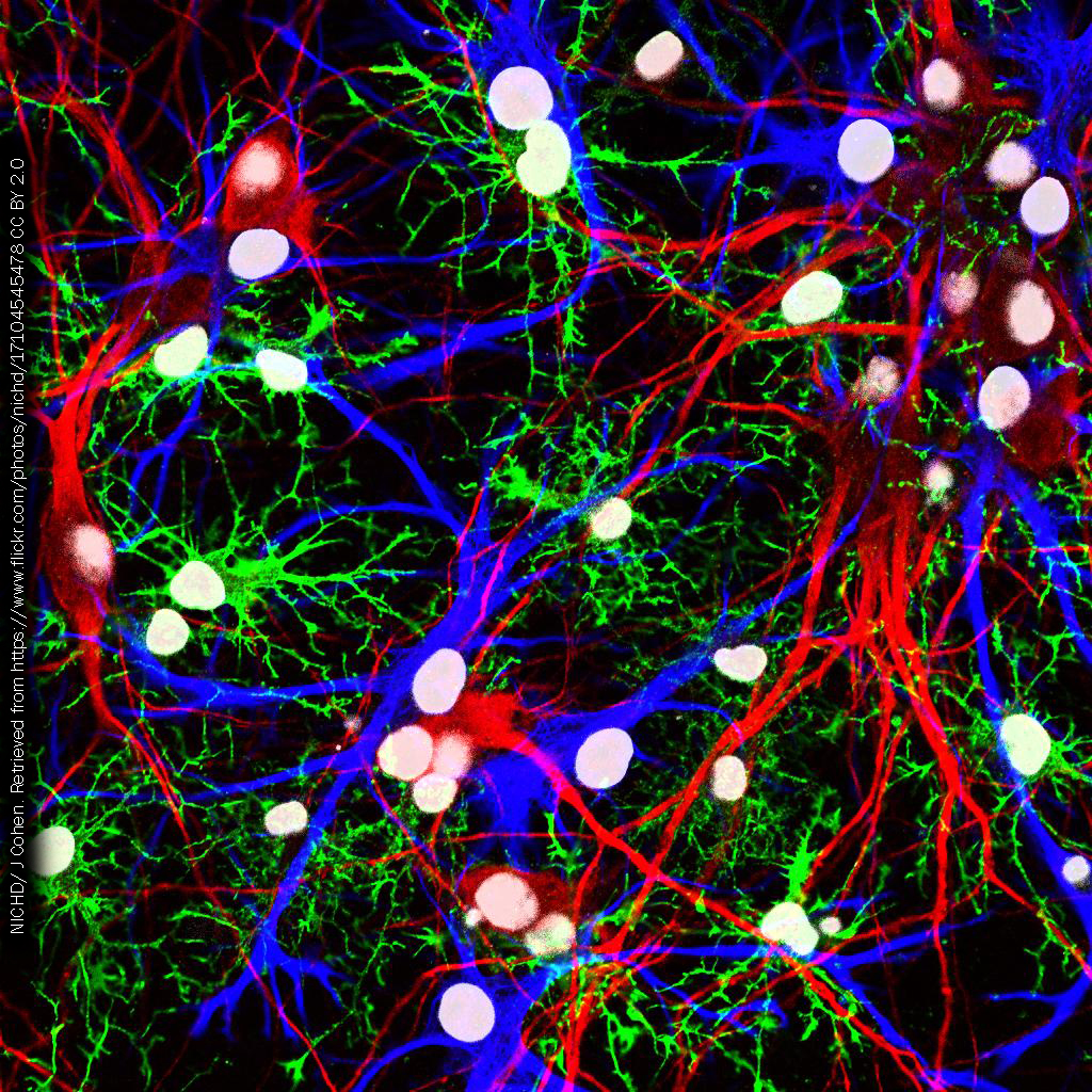 Fluorescence photomicrograph showing neurons, astrocytes, and oligodendrocytes from the brain in different colors.