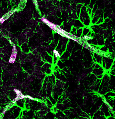 Fluorescence photomicrograph of astrocytes (stained green) and vessels (stained purple with aquaporin).