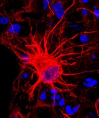 Fluorescence photomicrograph of an astrocyte in tissue culture.