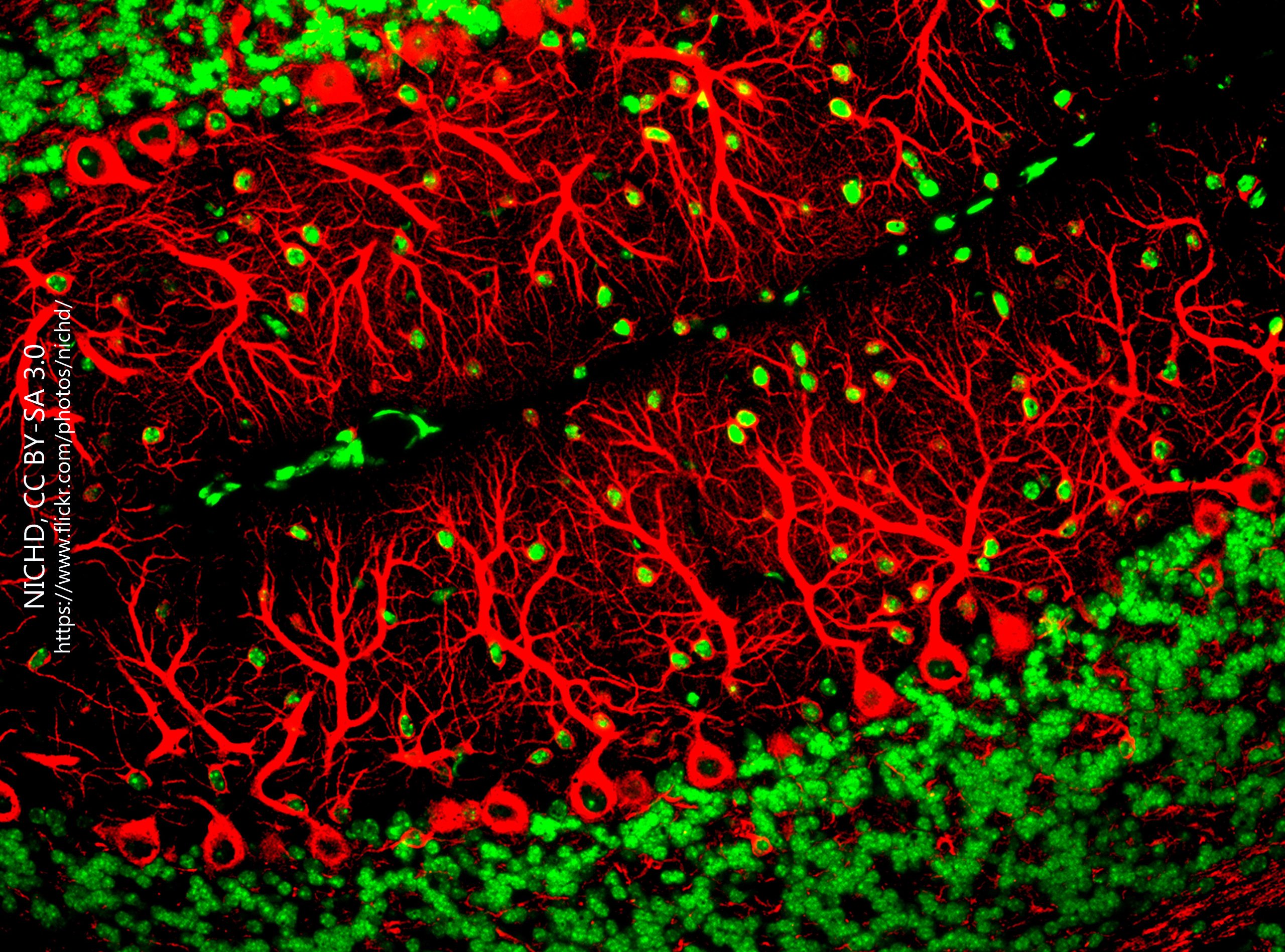 Immunofluorescence photomicrograph of Purkinje cells.