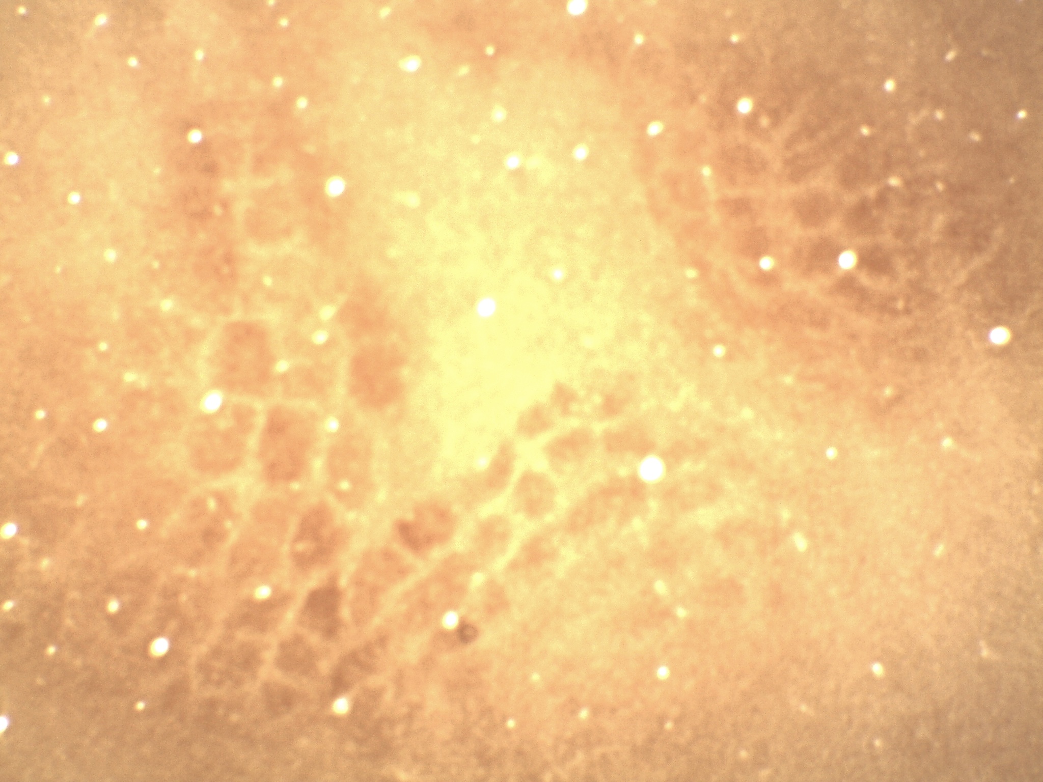 Photomicrograph of the barrel cortex in the rat (somatosensory cortex representing the vibrissae on the rat muzzle).