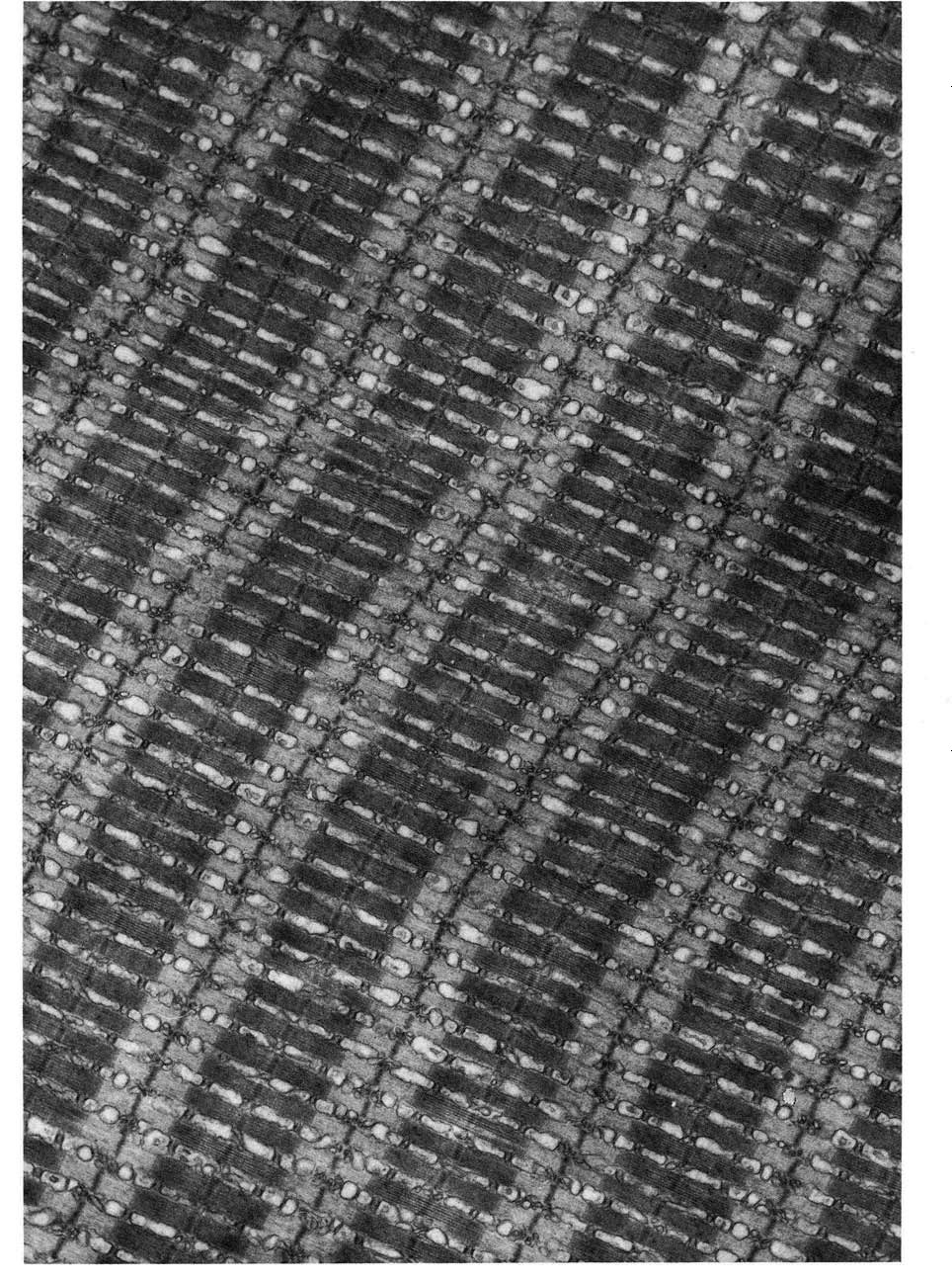 Electron micrograph of toadfish muscle showing the arrangement of T tubules and sarcoplasmic reticulum in a triad.