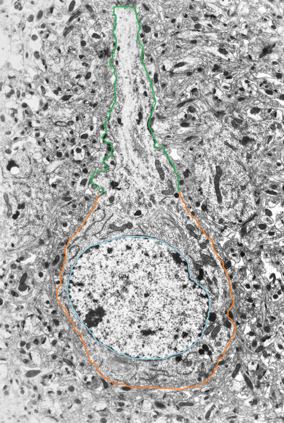 Electron micrograph of the neuronal cell body.