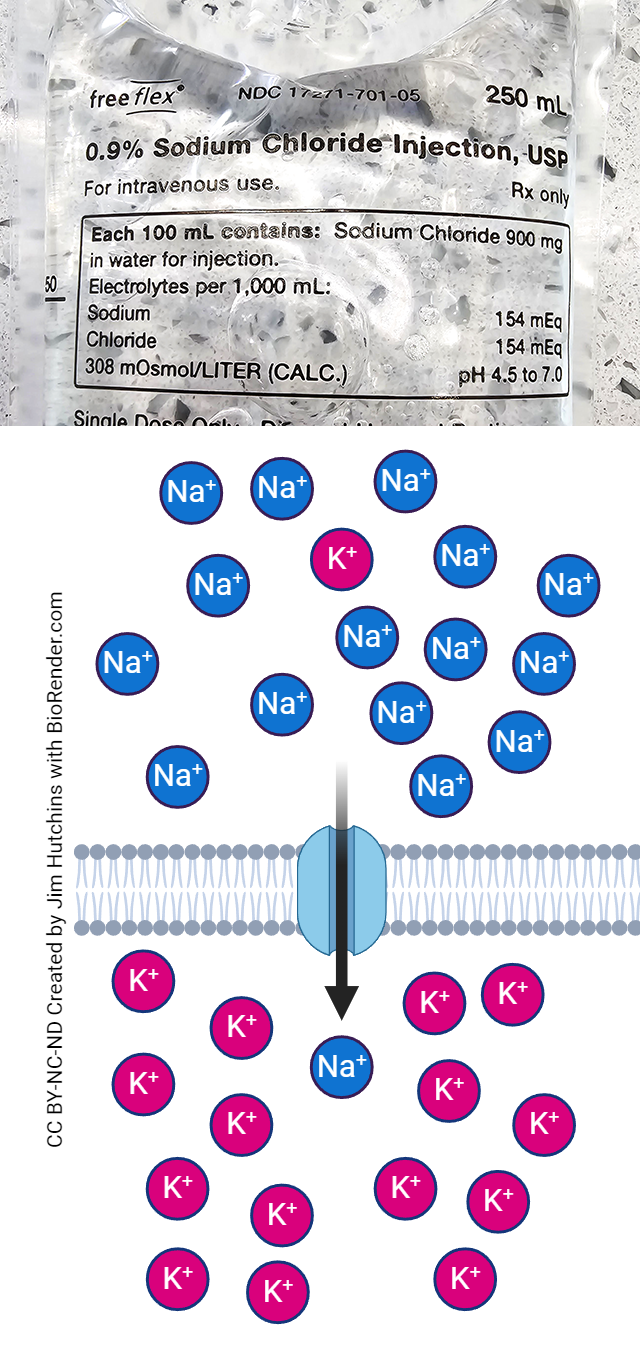Composite of a photograph of a bag of normal saline and a diagram of sodium moving through a leakage channel.