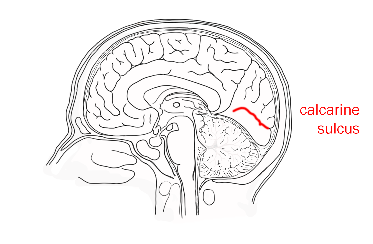 Diagram showing the location of the calcarine sulcus.