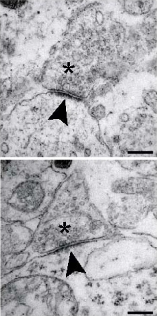 Electron micrograph illustrating the postsynaptic density in synapses of the mouse central nervous system.