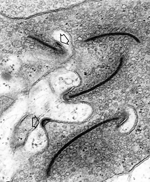 Transmission electron micrograph of synapses between photoreceptors and bipolar and horizontal cells in the larval salamander retina.